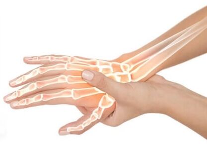 Hondrox se aplikuje na postiženou oblast