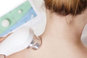 Fyzioterapie při léčbě cervikální osteochondózy