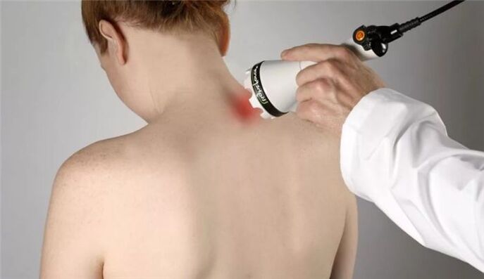 fyzioterapie pro léčbu cervikální osteochondrózy