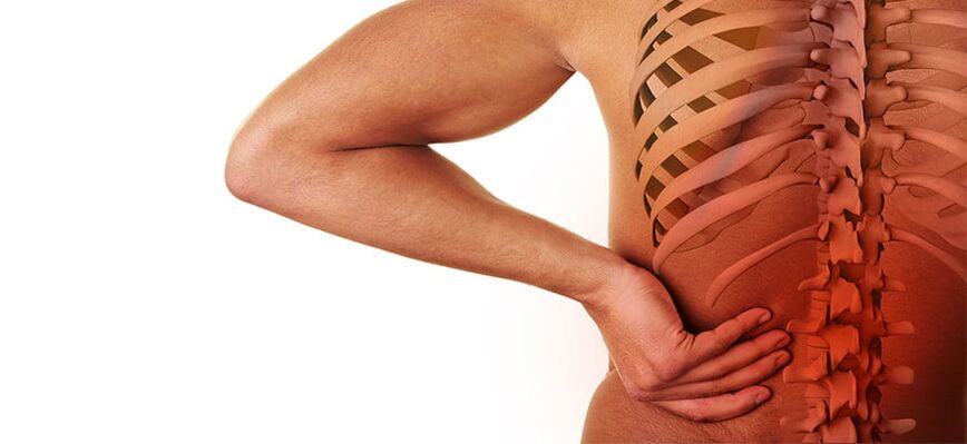 příznaky bederní osteochondrózy